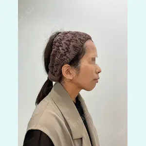ユウコ形成外科クリニック 植田　有子医師の症例