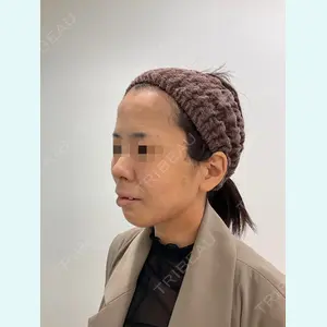 ユウコ形成外科クリニック 植田　有子医師の症例