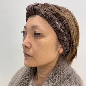 ユウコ形成外科クリニック 植田　有子医師の症例