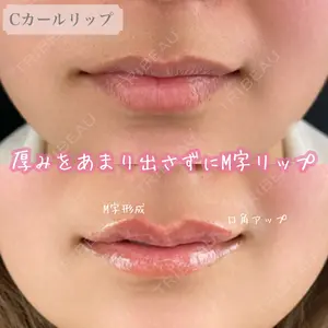 ルラ美容クリニック 渋谷本院の症例