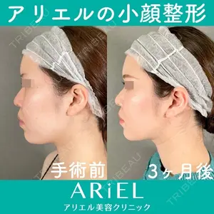 アリエル美容クリニック 大宮院 鈴木　桂介医師の症例