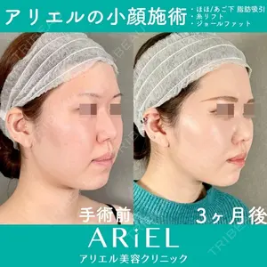 アリエル美容クリニック 大宮院 鈴木　桂介医師の症例