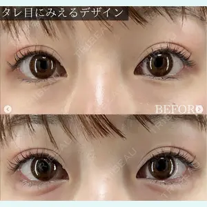 X CLINIC 恵比寿院の症例