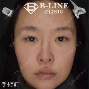 B-LINE CLINIC 池袋院 小池 康弘医師の症例