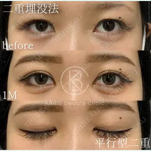 KARIS beauty clinic 滝内 ヒロフミ医師の症例