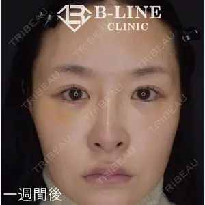 B-LINE CLINIC 池袋院 小池 康弘医師の症例