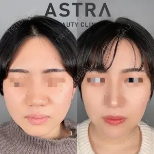 ASTRA BEAUTY CLINICの症例