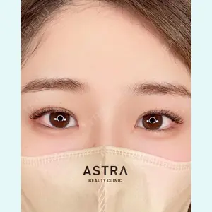 ASTRA BEAUTY CLINICの症例