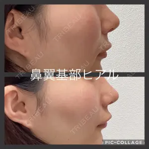 AYANAフィラーズクリニック 渋谷院 古田 晃医師の症例