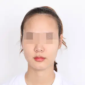 フェイスライン美容外科 ジャンヒョン医師の症例