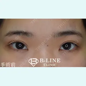 B-LINE CLINIC 池袋院 小池 康弘医師の症例