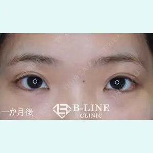 B-LINE CLINIC 池袋院 小池 康弘医師の症例