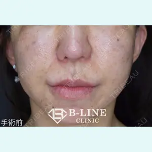 B-LINE CLINIC 池袋院 小池 康弘医師の症例