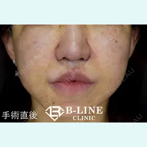 B-LINE CLINIC 池袋院 小池 康弘医師の症例