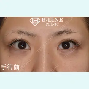 B-LINE CLINIC 池袋院 小池 康弘医師の症例