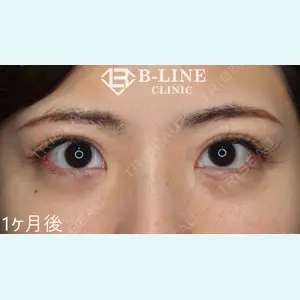 B-LINE CLINIC 池袋院 小池 康弘医師の症例