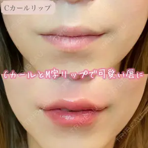 ルラ美容クリニック 渋谷本院の症例