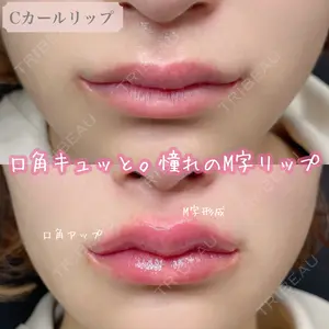ルラ美容クリニック 渋谷本院の症例