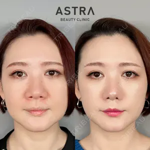 ASTRA BEAUTY CLINICの症例