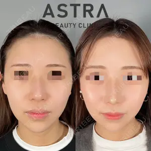 ASTRA BEAUTY CLINICの症例