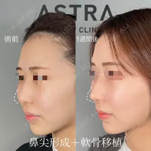 ASTRA BEAUTY CLINICの症例