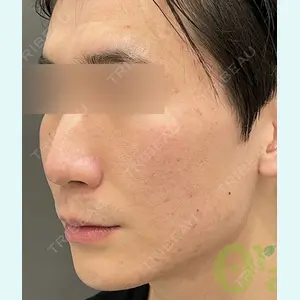 オラクル美容皮膚科 東京新宿院の症例