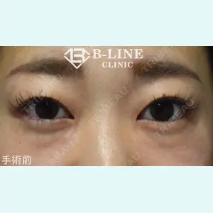 B-LINE CLINIC 池袋院 小池 康弘医師の症例