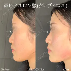 ルラ美容クリニック 千葉院 下川 洋輝医師の症例