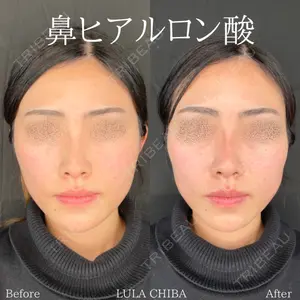 ルラ美容クリニック 千葉院 下川 洋輝医師の症例