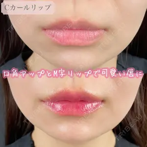 ルラ美容クリニック 渋谷本院の症例