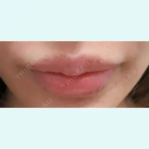 銀座TAクリニックの症例