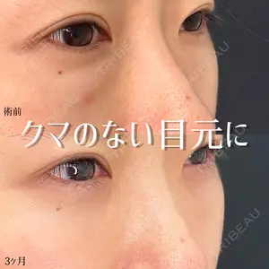 東京シンデレラ美容外科 池袋院の症例