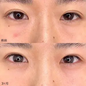 東京シンデレラ美容外科 池袋院の症例
