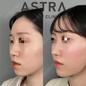 ASTRA BEAUTY CLINICの症例