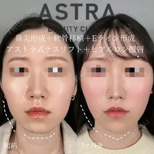 ASTRA BEAUTY CLINICの症例