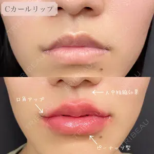 ルラ美容クリニック 渋谷本院の症例
