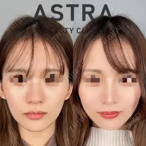 ASTRA BEAUTY CLINICの症例