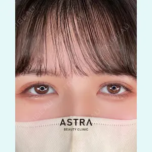 ASTRA BEAUTY CLINICの症例