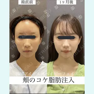 EMMO FACE CLINIC 大宮院 廣松 直樹医師の症例