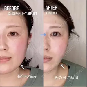 TIAM CLINIC GINZA 谷口 弘樹医師の症例