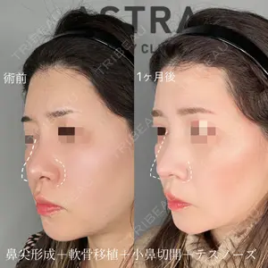 ASTRA BEAUTY CLINICの症例