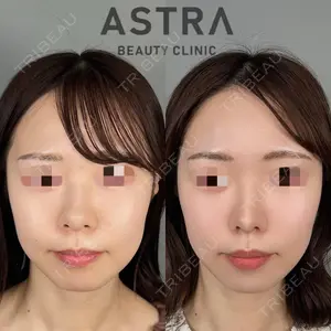 ASTRA BEAUTY CLINICの症例