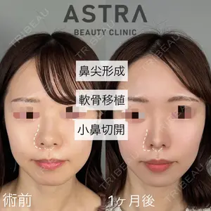 ASTRA BEAUTY CLINICの症例