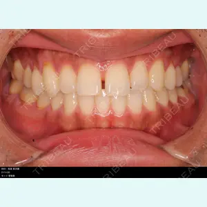 Shiny Teeth Clinic 【シャイニー ティース クリニック】 高橋 直人医師の症例