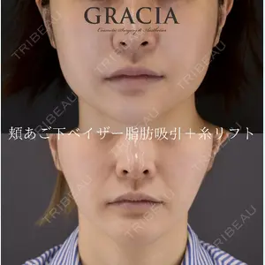 Casa de GRACIA GINZA 樋口　隆男理事長医師の症例