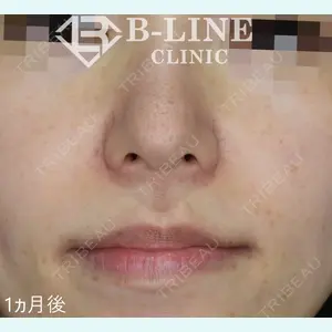 B-LINE CLINIC 池袋院 小池 康弘医師の症例