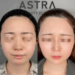 ASTRA BEAUTY CLINIC 塩満 惠子医師の症例