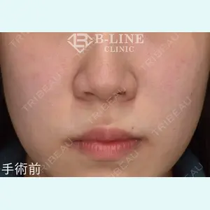 B-LINE CLINIC 池袋院 小池 康弘医師の症例