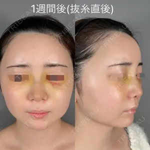 ASTRA BEAUTY CLINIC 塩満 惠子医師の症例