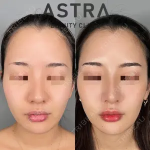 ASTRA BEAUTY CLINIC 塩満 惠子医師の症例